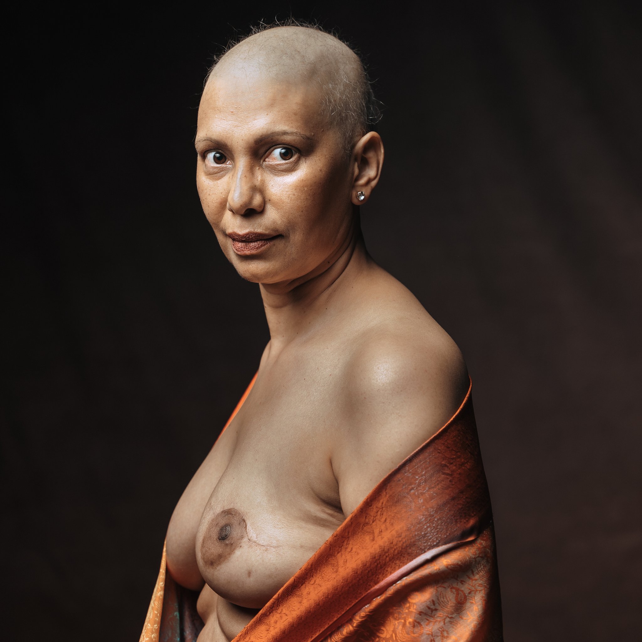 une femme qui a le cancer du sein, pose avec sa cicatrice, une femme qpose en s'amusant, seance photo pour lutter contre le cancer du sein
